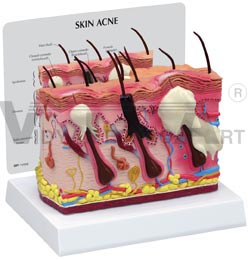 Skin Normal Acne